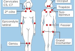 fibromyalgie naturellement